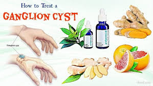 Pin On Natural Healing