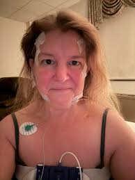 Do sleep studies help with fibromyalgia diagnosis?