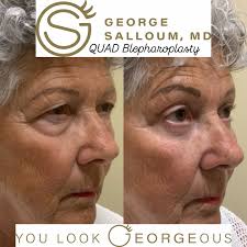 George Salloum, M.D. (@georgesalloummd) · Syracuse, NY