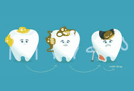 Resultado de imagen de &iquest;C&oacute;mo evitar las caries?