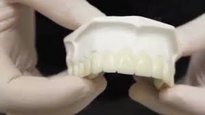 Temporary tooth repair kit temp dental fix missing for 30 teeth! Brutal Truth The Dentists Don T Tell You When They Promise You A Dazzling Smile Daily Mail Online