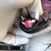 See mouth cancer pictures to learn what common mouth cancer sores on the tongue, gums, and cheek look like. 1