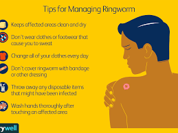 We turned to infectious disease experts to set things straight. How Ringworm Is Treated