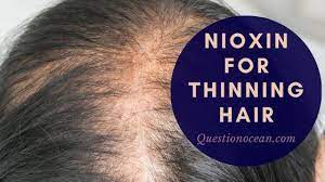 You don't do that unless your product really works. Nioxin For Thinning Hair Faqs Does It Really Work Questionocean