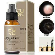 It usually develops several months post coronavirus. Natural Ginger Extract Hair Growth Spray Anti Hair Loss Hair Repair Essence 30ml Ebay