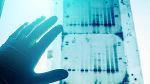 Viewpoint: Ancestry DNA testing may reveal more than consumers bargained  for - Boston Business Journal