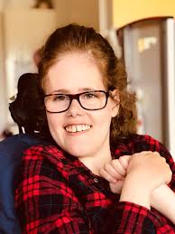 What is the maximum age of your children with alobar holoprencephaly? my  daughter only lived 7 months