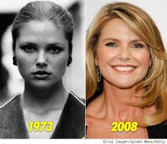 Plastic surgery procedures started as medical treatments but grew into cosmetic surgeries. Christie Brinkley Christine Macdonald