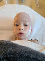 Teenager gets stitches after head injury