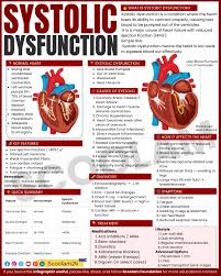 Image result for Systolic Dysfunction