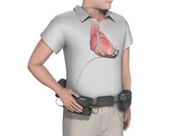 Learn about torso muscles with free interactive flashcards. 4qwer9o4zyx6nm