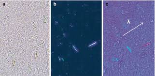 Image result for Polarized Microscopy