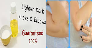 Repeat the process on alternate days for a week, and you'll notice the difference. How To Lighten Dark Elbows And Knees Naturally Maxdio
