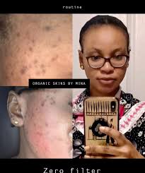 Instagram: @organicskincarebymina Facebook: Organic Skincare By MINA  TikTok: Organic Skincare By MINA Snapchat: @Mina_Ous Site:  organicskinsbymina.com USA: +19014621006 Dakar: 781818989 Gambie:  +2202003334
