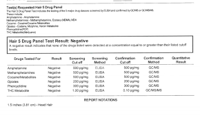 28 Albums Of Negative Hair Follicle Drug Test Results