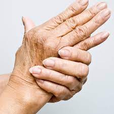 Tangan kebas atau kesemutan adalah suatu kondisi yang tidak boleh diabaikan apabila terjadi terlalu sering, di mana keluhan bisa terjadi pada satu sisi. Set Kebas Tangan Shaklee Pengedar Shaklee Shah Alam