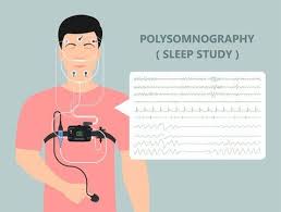 Image result for Polysomnogram