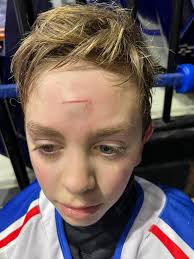 Billet Kids Playing Against Each Other in Hockey