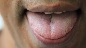 If there is an r after the letter u (and the r does not have a vowel after it), u has a different pronunciation. The Man Opens The Mouth Stock Footage Video 100 Royalty Free 27053305 Shutterstock