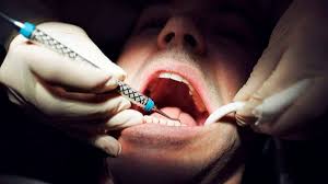 We can help locate the best dental insurance policy for you or your family! Tooth Hurts And No Dental Insurance Here Are 4 Things You Should Know About Dental Discount Plans Chicago Tribune