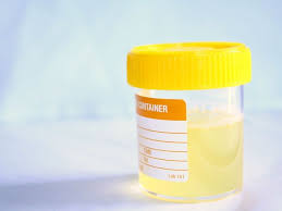 Air seni untuk ukuran orang sehat ditunjukkan dengan warna jernih, warna putih atau kuning pucat atau gelap bisa dikatakan sehat dan dipengaruhi menurut dr ellerkmann, air seni orang yang hamil ditunjukkan dengan aroma yang menyengat, warnanya lebih pekat dari air seni yang biasanya keluar. 10 Arti Warna Air Urine Terhadap Kesehatanmu Apakah Kamu Cukup Minum