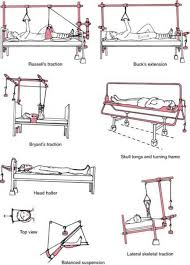 Requires hydrotherapy and land physiotherapy or if child is allergic to skin extensions. Nursing Crib Traction Get More Nclex Review Questions Facebook