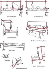 How to apply bucks traction and education. Nursing Crib Traction Get More Nclex Review Questions Facebook