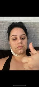 How Long COVID has become the 'silent pandemic' • Michigan Advance