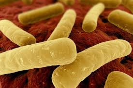 Under certain conditions, these organisms may grow in foods. Fsa Uk Scotland Several Batches Recalled For Concerns About Clostridium Botulinum Food Law Latest