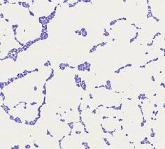 Image result for Staphylococcus Saprophyticus