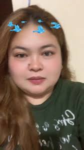 Darly Sanchez Amputee