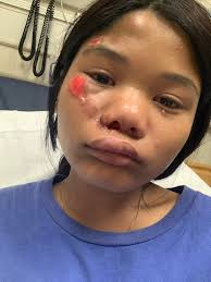 Two individuals stole the catalytic converter from my nephew's 2008 Honda  Element