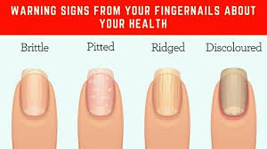 Warning Signs From Your Fingernails About Your Health Fingernail Health Signs Nail Health Signs Fingernail Health