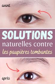 Solutions Naturelles Contre Les Paupieres Tombantes En 2020 Paupieres Tombantes Soin Visage Maison Beaute Du Visage