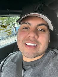 Porcelain veneers for a natural smile