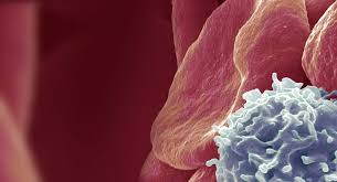 Image result for Leukemia