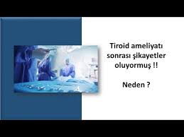 Tiroid Ameliyati Sonrasi Sikayetler Oluyormus Neden Youtube