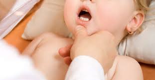 Herpangina Una Infeccion Comun Entre Bebes Y Ninos