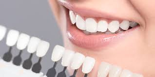 Teeth Veneers Dentist Farmington Hills Veneers Costs And