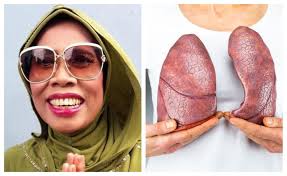 6 Cara Mudah Membuat Paru-paru Selalu Sehat, Penyintas Penyakit Ini Paling  Berisiko Kematian Saat Pandemi Covid-19