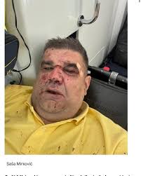 Pretučen Saša Mirković producent, vlasnik i direktor Hype TV