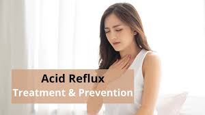 The Best Acid Reflux Treatment Options and Ways to Prevent it