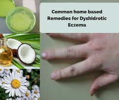 Dyshidrotic Eczema Home Remedies Toenailfungusremedies Home Remedies For Eczema Eczema On Hands Toenail Fungus Remedies