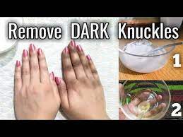 Lighten Dark Knuckles Naturally With 2 Home Remedies Whiten Knees Elbow Ankle Tips Urdu Hindi Yo Dark Knuckles Dark Spots On Skin Remove Dark Skin Spots