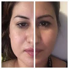 Dr. Armando Corral C. (@dr.accota) • Instagram photos and videos