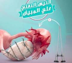 منظار البطن يزيل الكيس الدهني على المبيض الحامل الحمل والولادة Ballet Shoes Sport Shoes Dance Shoes