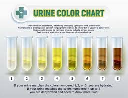 Nc Senior Living Solutions Private Consulting Firm Senior Living And Home Care Placement On Linkedin The Importance Of Staying Hydrated Great Chart To Us Color Of Urine Color Chart Urinal