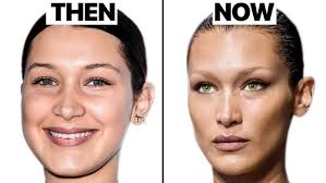 Can A Plastic Surgeon Guess Who's Had Plastic Surgery?