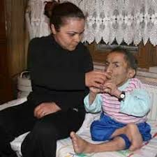 Iste Keloglanin Simdiki Hali