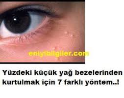 Yuzdeki Kucuk Yag Bezelerinden Kurtulmanin 7 Farkli Yolu Yag Dogal Cilt Yuzler